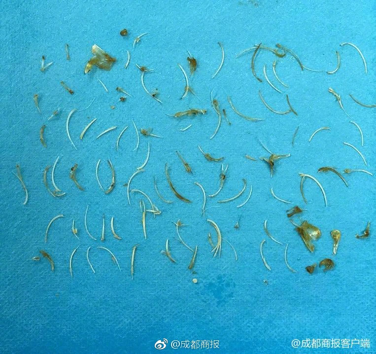 【揭秘】中國光通信強國之路：從應用到技術前沿
